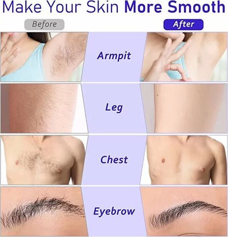 3-in-1 Roll-On Waxing Deal - Genzzes