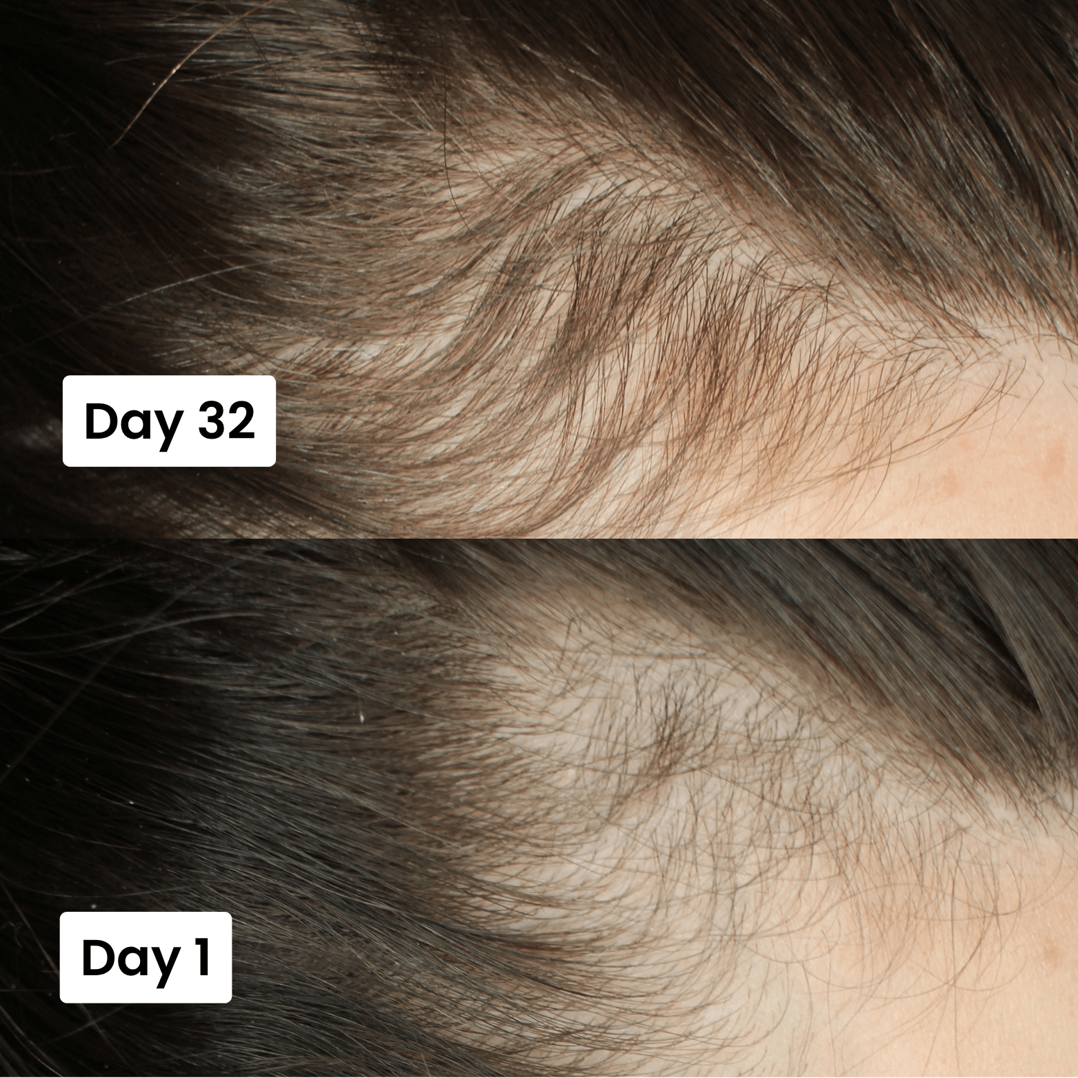 Scalp Hair Growth Serum - Genzzes