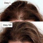 Scalp Hair Growth Serum - Genzzes