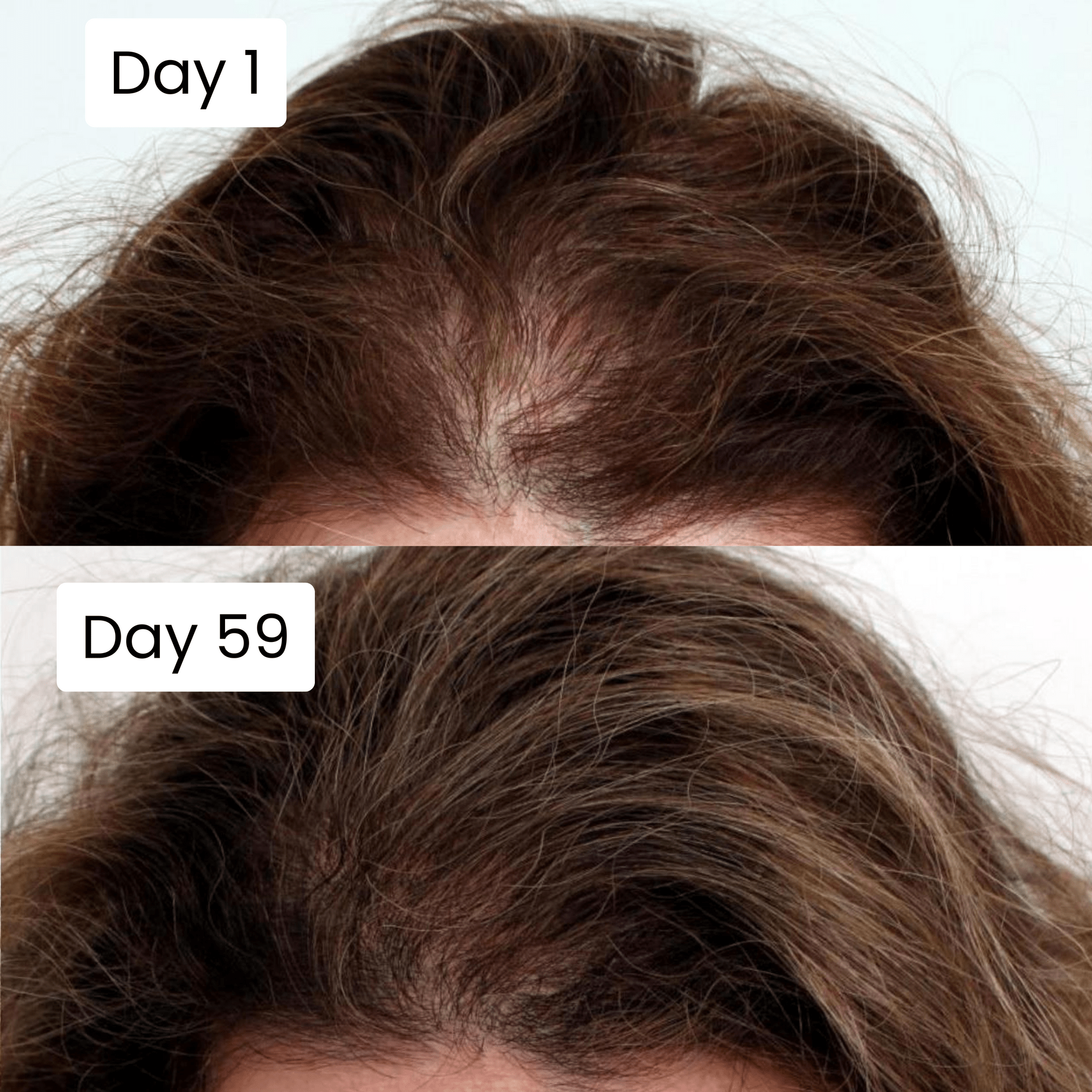 Scalp Hair Growth Serum - Genzzes