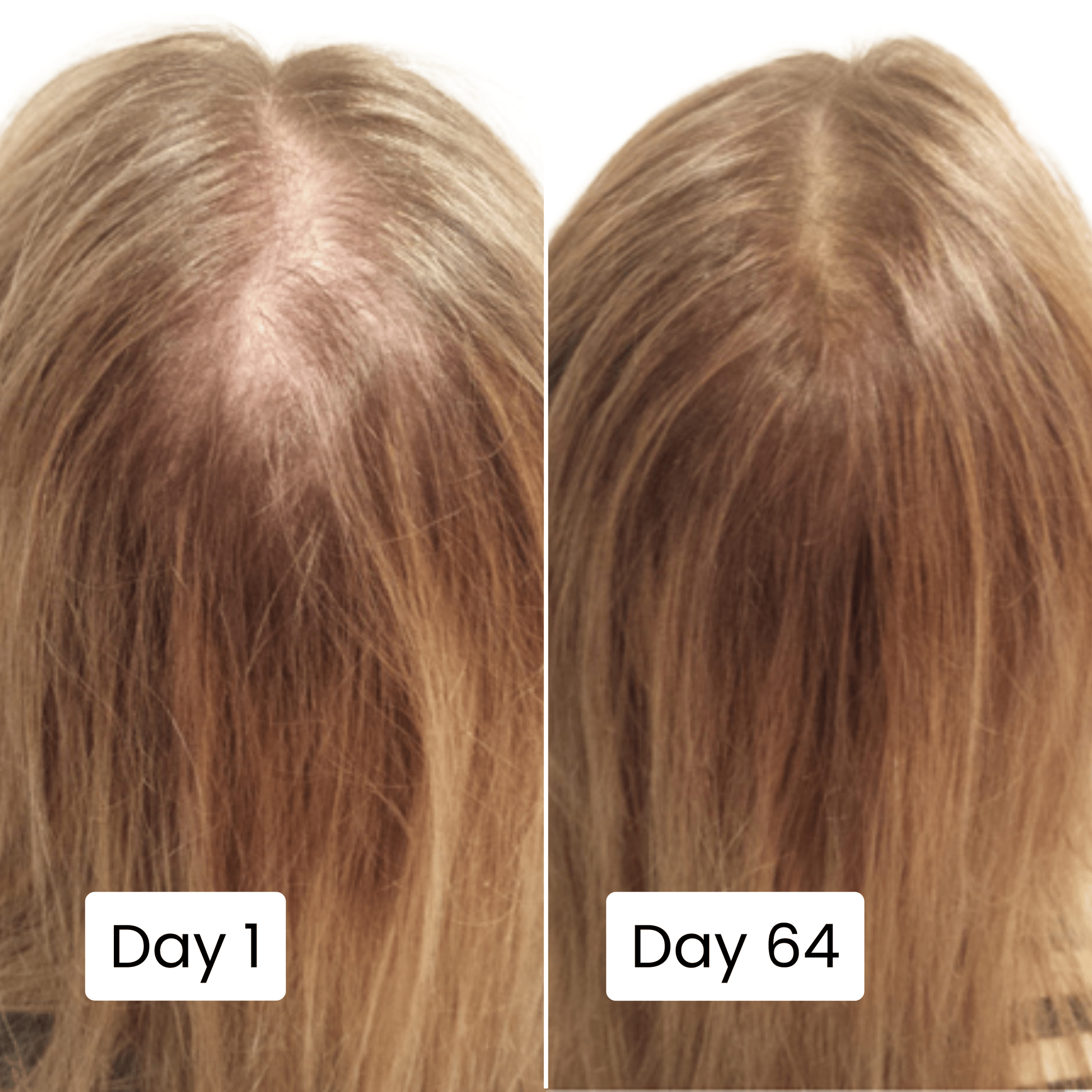 Scalp Hair Growth Serum - Genzzes