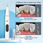 Smart Ultra-Sonic Teeth Cleaner