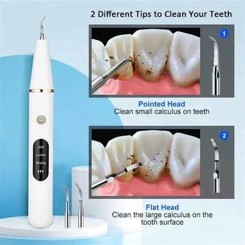 Smart Ultra-Sonic Teeth Cleaner