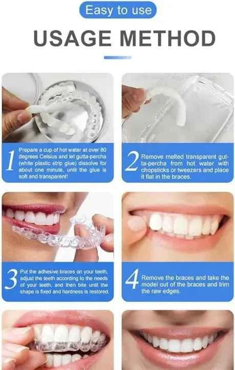 Smile Veneers