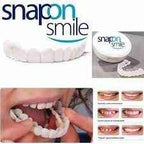 Smile Veneers
